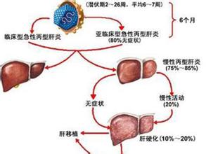 肝炎常识