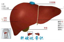 肝硬化失代偿期